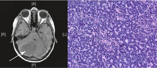 Bildquelle: Universit&auml;tsklinikum Heidelberg