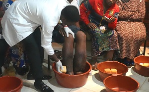 Project staff familiarize people with special hygiene measures to help them avoid contracting podoconiosis or alleviate its symptoms. Project staff familiarize people with special hygiene measures to help them avoid contracting podoconiosis or alleviate its symptoms.