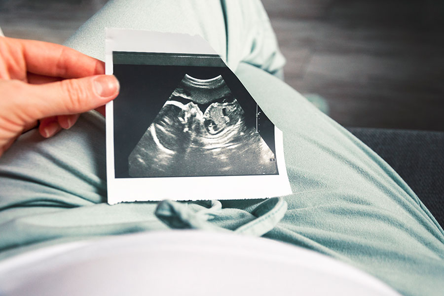 Junge Frau hält ein Ultraschallbild des Babys in der Hand. Junge Frau hält ein Ultraschallbild des Babys in der Hand.