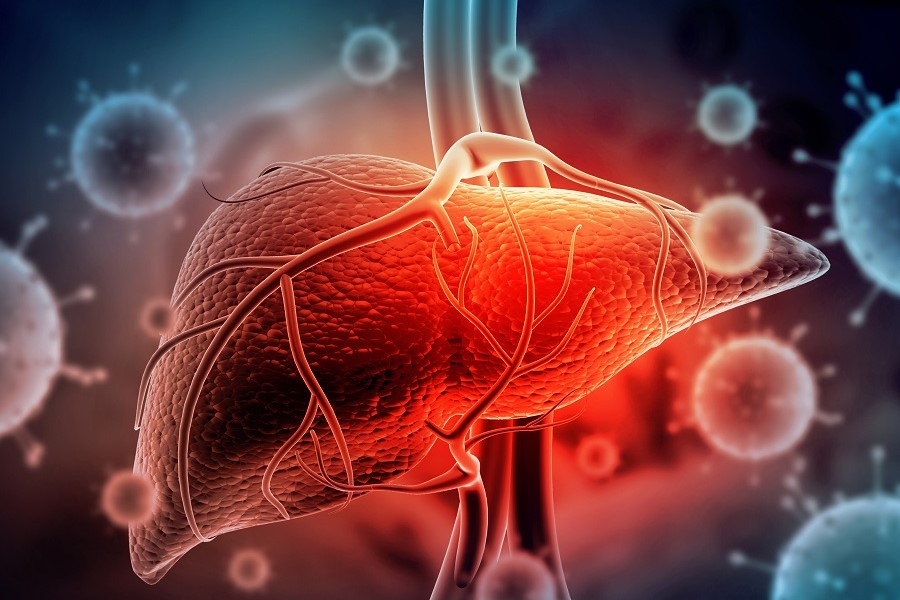 Grafische Darstellung einer Leber, die von Viren umgeben ist.