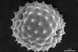 Mikroskopische Aufnahme eines Ambrosiapollenkorns – ein Pollen mit besonders hohem Allergiepotenzial. 