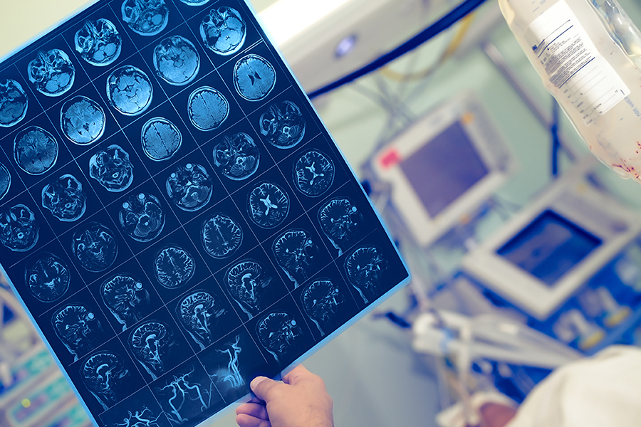 Folie mit Aufnahmen des Gehirns in der Hand einer medizinischen Fachkraft in Klinikraum Folie mit Aufnahmen des Gehirns in der Hand einer medizinischen Fachkraft in Klinikraum
