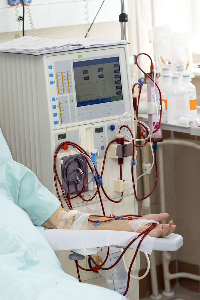 Blutreinigung mittels Dialyse 