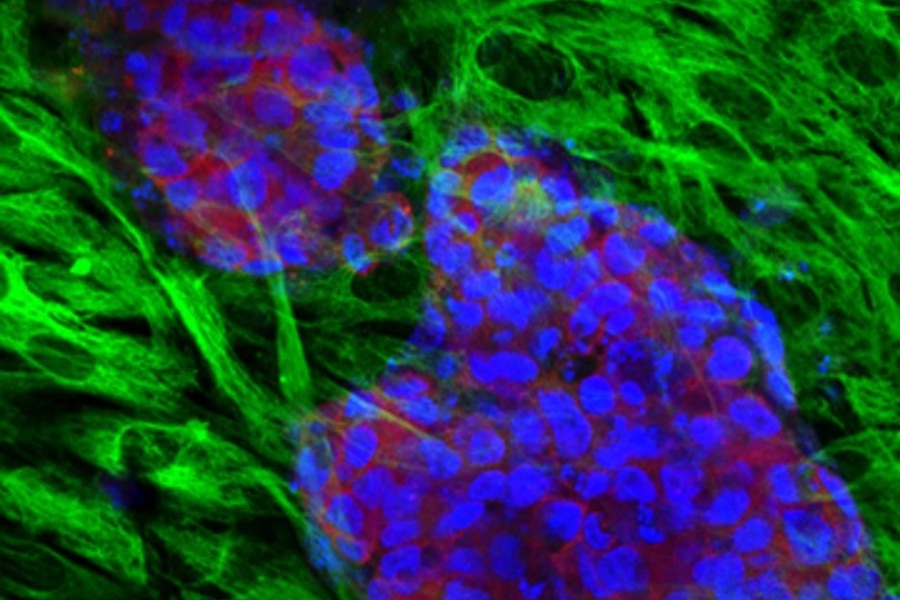 Endometriosezellen im 3D Modell