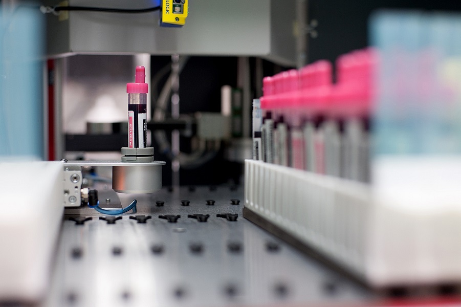 Reagenzbehälter mit Blutproben bei der automatischen Registrierung