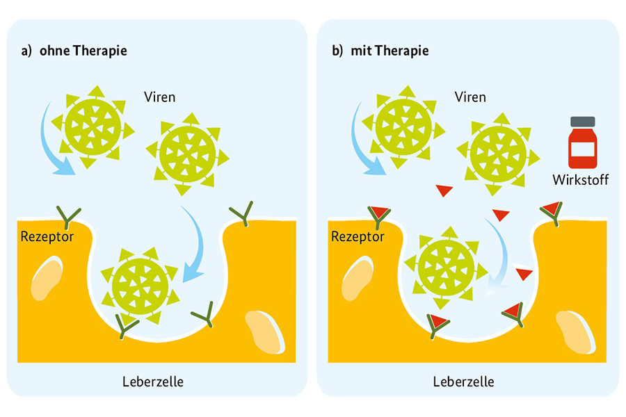 Grafik einer Leberzelle mit und ohne Therapie Grafik einer Leberzelle mit und ohne Therapie