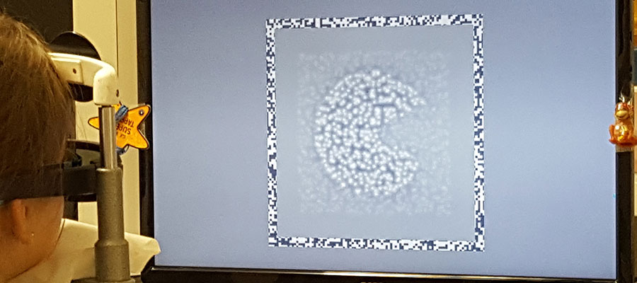 Bei Kindern mit der Sehschwäche Amblyopie können mit neuen digitalen Diagnoseverfahren genauere Messungen ihres 3-D-Sehens gelingen.