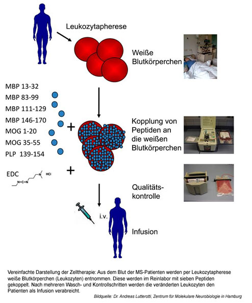 Bildquelle: Dr. Andreas Lutterotti, Zentrum für Molekulare Neurobiologie in Hamburg Bildquelle: Dr. Andreas Lutterotti, Zentrum für Molekulare Neurobiologie in Hamburg