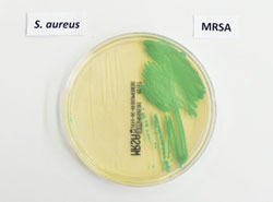 Bildquelle: Universit&auml;tsklinikum M&uuml;nster