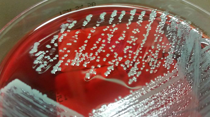 So sehen Staphylococcus aureus Bakterien-Kolonien aus. Im Labor werden die Bakterien auf speziellen N&auml;hrb&ouml;den gez&uuml;chtet.