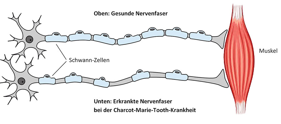 Schematische Darstellung der Myelinschicht