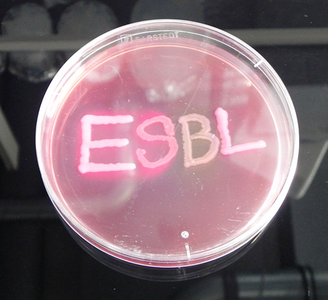 Multiresistente Keime in einer typischen Laborschale. Im Labor werden die Bakterien auf speziellen Nährböden gezüchtet. Aber auch in unserer Umwelt wachsen multiresistente Keime. Foto: Justus-Liebig Universität Gießen 