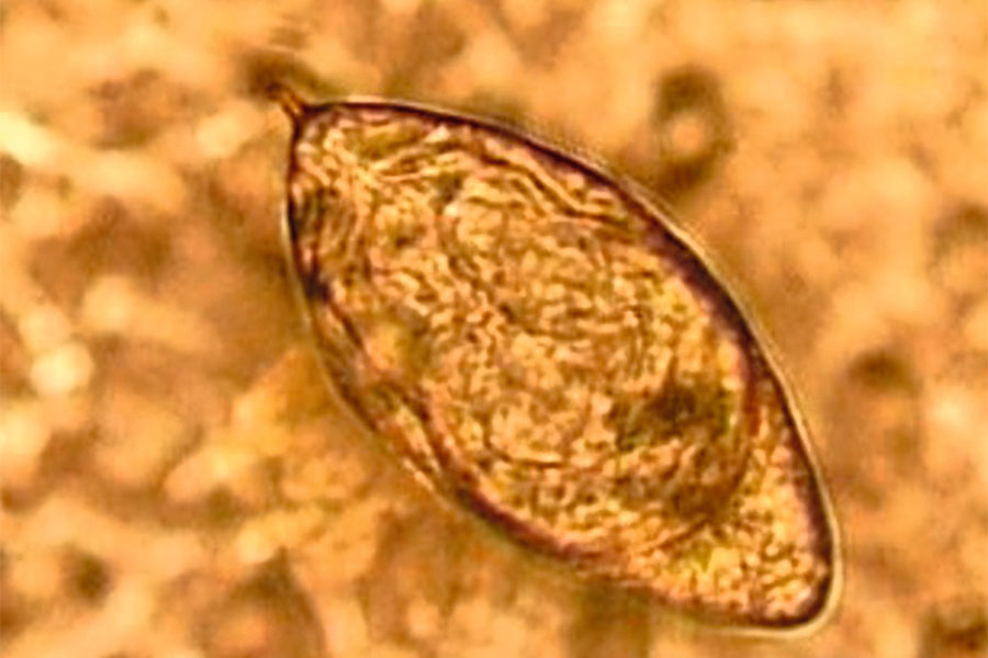 So sehen die Eier des Saugwurmes Schistosoma haematobium, Erreger der gef&auml;hrlichen Infektionskrankheit Bilharziose (Schistosomiasis), unter dem Mikroskop aus.