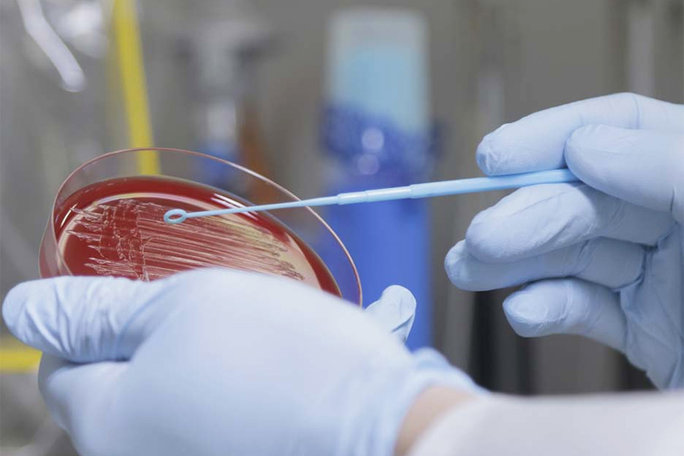 Zwei Hände mit blauen Gummihandschuhen halten eine Petrischale mit rotem Nährboden in der Hand.