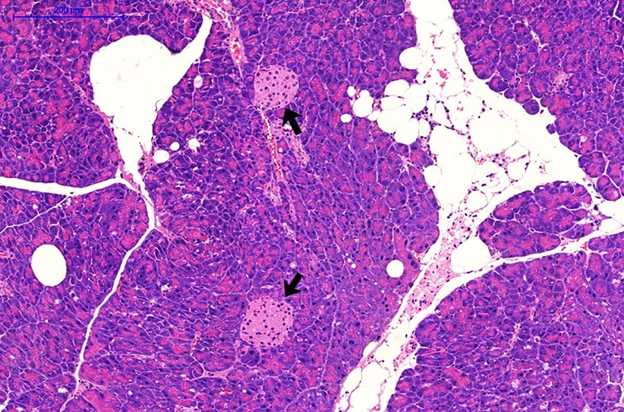 Lichtmikroskopische Aufnahme der Bauchspeicheldrüse einer diabetesanfälligen Maus. Die Fettzellen sind weiß, und die insulinproduzierenden Zellen in den sogenannten Langerhans-Inseln sind mit schwarzen Pfeilen markiert. 