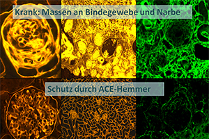 Nierengewebe
