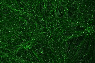 In der Petrischale hergestellte menschliche Neuronen