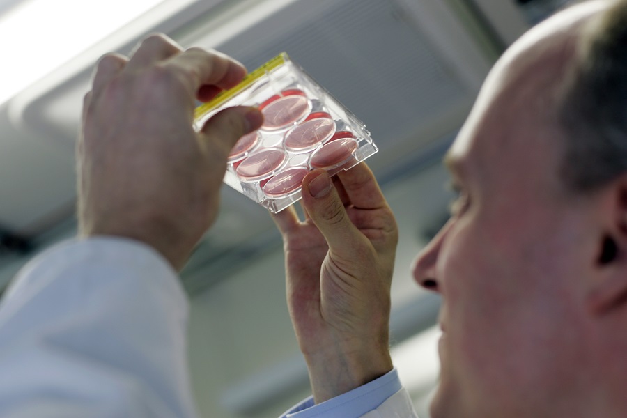 Wissenschaftler schaut sich Nährmedien in Kulturschalen an.