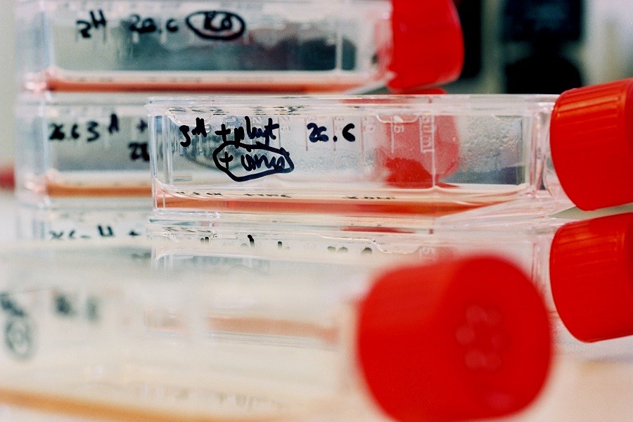 Flaschen mit Zellkulturen in einem Nährmedium