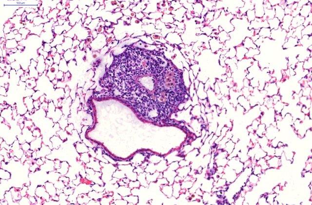 Mikroskopische Aufnahme eines induzierbaren bronchienassoziierten Lymphknoten, iBALT, im Lungengewebe. 