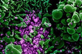 Koloriertes Rasterelektronenmikroskopbild einer apoptotischen Zelle