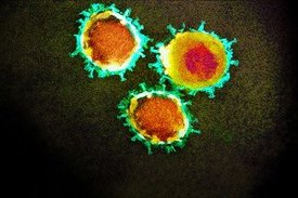 Elektronenmikroskopische Aufnahme des Coronavirus.