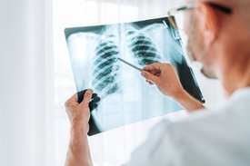 Eine Person betrachtet ein Röntgenbild einer Lunge