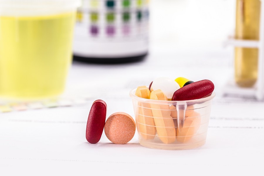 Gefäß mit Harnprobe und davor Becher mit verschiedenfarbigen Tabletten