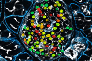 Mikroskopische Darstellung von Betazellen