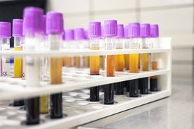 Blutproben aus der Uniblutbank. 