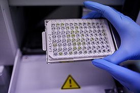 Bestimmung des Botenstoffs TGFβ