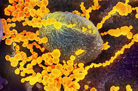 Rasterelektronenmikroskopische Aufnahme von SARS-CoV-2 Partikeln, die aus der Oberfläche von im Labor gezüchteten Zellen hervortreten.