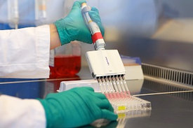 Adrenomedullin-Werte bei schweren COVID-19-Fällen stark erhöht