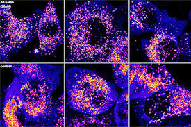 Die Zellen in der oberen Reihe wurden mit dem Fluoxetin-ähnlichen Molekül AKS466 behandelt und danach mit SARS-CoV-2 infiziert. Die Zellen unten wurden nur infiziert; in ihnen ist deutlich mehr virale RNA nachweisbar (hellere Punkte).