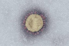 Das neue SARS-Coronavirus-2 unter dem Elektronenmikroskop (Maßstab: 100 nm). © Robert Koch-Institut 