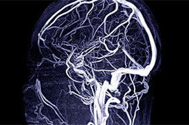 Social Distancing Maßnahmen haben Covid-19 in Deutschland effektiv eingedämmt