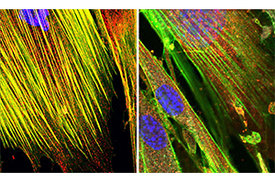 Lichtmikroskopieaufnahme von primären humanen Lungenzellen. 