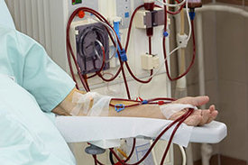 Blutreinigung mittels Dialyse