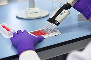 Kleine Mengen an Flüssigkeiten werden mit einer Mehrfachpipette pipettiert