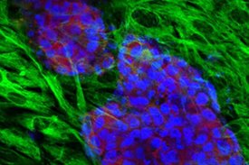 Endometriosezellen im 3D Modell