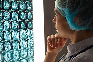 Medizinerin betrachtet Aufnahmen des Gehirns