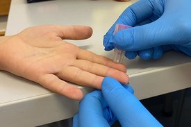 Blutabnahme aus der Fingerkuppe