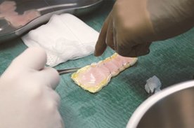 Auf einem OP-Tisch liegt ein mehrlagiges Herzpflaster, das für den Einsatz am Herzen vorbereitet wird