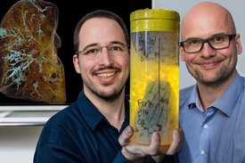 Professor Dr. Danny Jonigk (rechts) und Christopher Werlein mit dem linken Oberlappen eines COVID-19-Verstorbenen in einem für die Messung im HiP-CT geeigneten Spezialbehälter