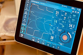 Beatmungsgeräte sind unerlässlich für die Behandlung schwerer Fälle von COVID-19, jetzt kommt eine medikamentöse Unterstützung in Sicht.