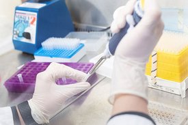 Im Institut für Molekulare Virologie wird ein Experiment vorbereitet