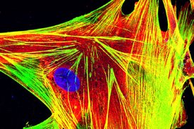 Zwei Abbildungen mit nadelförmige Linien, kleinen Punkten und ovalen Flächen in unterschiedlichen Farben