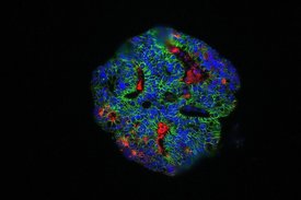 Mit dem neuartigen Coronavirus, SARS-CoV-2, infizierte Minidarm-Organoide (virales N-Protein rot, Epithelmarker E-cadherin grün, Zellkerne blau)
