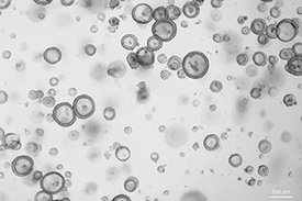 Tumororganoide unter dem Mikroskop