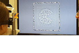 Bei Kindern mit der Sehschwäche Amblyopie können mit neuen digitalen Diagnoseverfahren genauere Messungen ihres 3-D-Sehens gelingen.